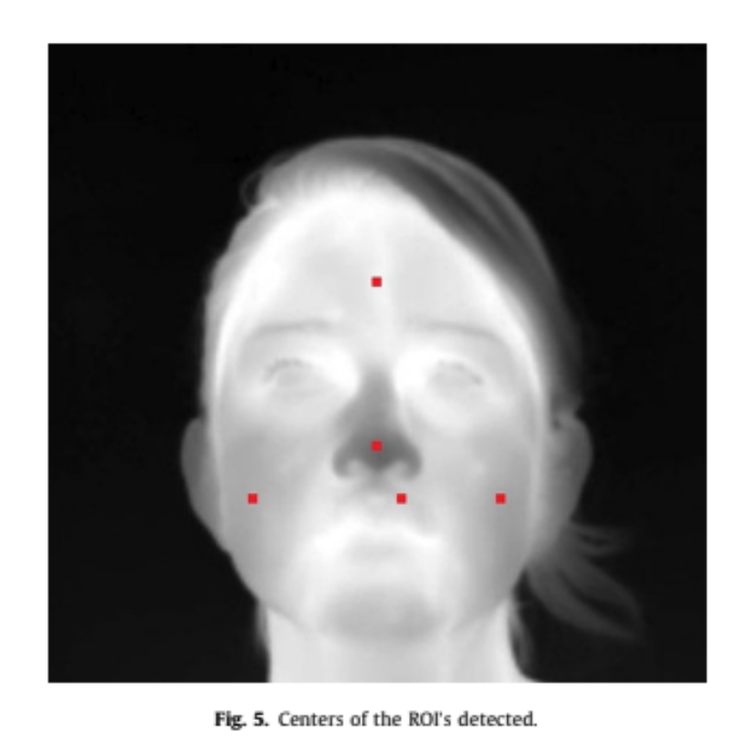 Termisk ansiktsbild - Regions of Interest